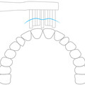 Сменные насадки для зубной щетки Xiaomi Electric Toothbrush Mini (DDYST02SKS) 3 шт.(#2)